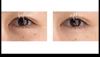 אליקסירים מתחת לעיניים: הרחקת עיגולים כהים עם הקונסילר המושלם