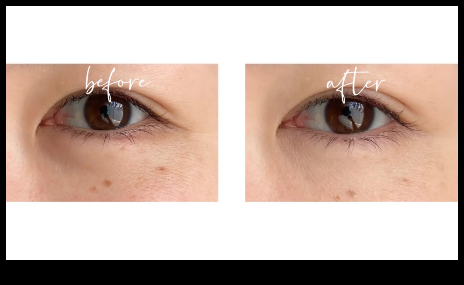 אליקסירים מתחת לעיניים: הרחקת עיגולים כהים עם הקונסילר המושלם